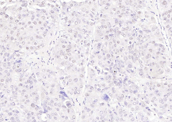 APPL1 Rabbit Polyclonal Antibody