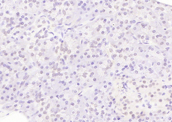 APPL1 Rabbit Polyclonal Antibody