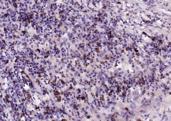 IL-2 Rabbit Polyclonal Antibody