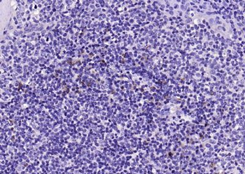 IL-2 Rabbit Polyclonal Antibody