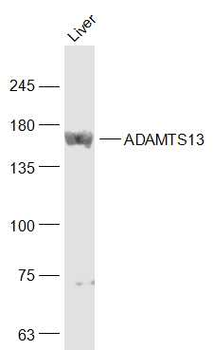 ADAMTS13 Rabbit Polyclonal Antibody