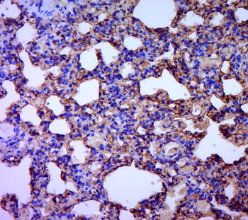 Aquaporin 5 Rabbit Polyclonal Antibody