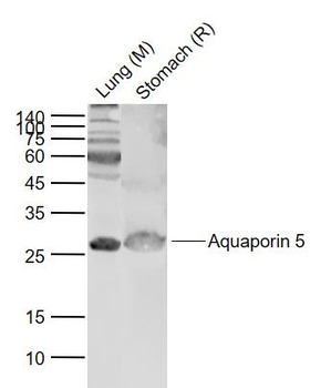 Aquaporin 5 Rabbit Polyclonal Antibody