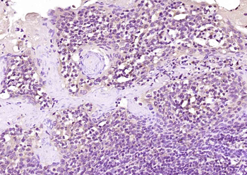 AIM2 Rabbit Polyclonal Antibody