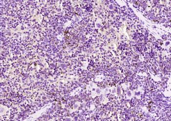 AIM2 Rabbit Polyclonal Antibody