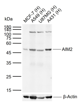 AIM2 Rabbit Polyclonal Antibody