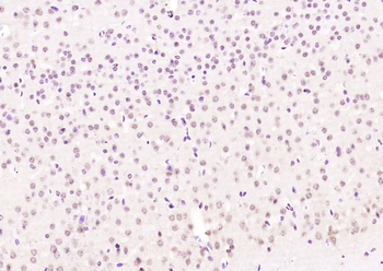 MTUS1 Rabbit Polyclonal Antibody