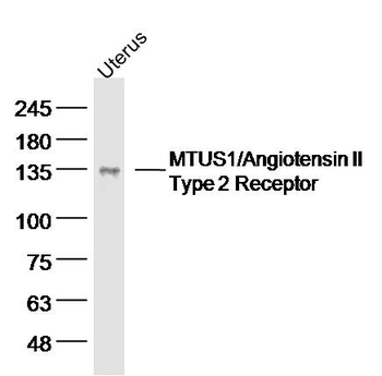 MTUS1 Rabbit Polyclonal Antibody