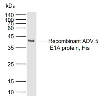 Adenovirus 5 E1A Rabbit Polyclonal Antibody