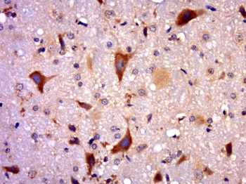 RAB8A Rabbit Polyclonal Antibody