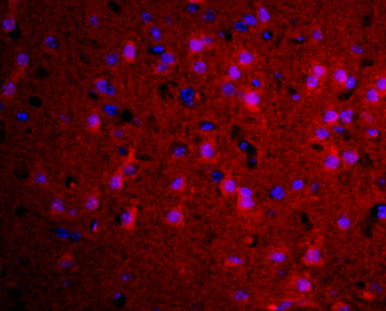 Transglutaminase 2 Rabbit Polyclonal Antibody