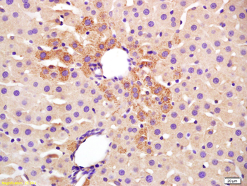 Transglutaminase 2 Rabbit Polyclonal Antibody