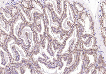 Phospho-AR/Androgen receptor (Ser578) Rabbit Polyclonal Antibody