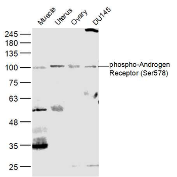 Phospho-AR/Androgen receptor (Ser578) Rabbit Polyclonal Antibody