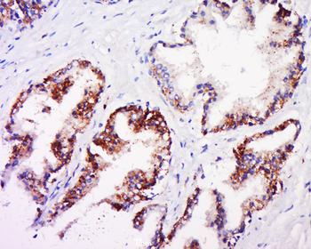 Phospho-AR/Androgen receptor (Ser578) Rabbit Polyclonal Antibody