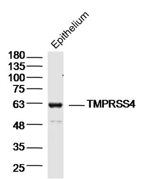 TMPRSS4 Rabbit Polyclonal Antibody