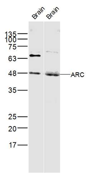 ARC Rabbit Polyclonal Antibody