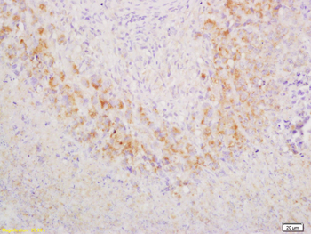 GCET2 Rabbit Polyclonal Antibody