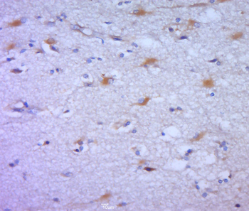 FCAR/CD89 Rabbit Polyclonal Antibody