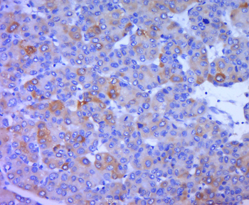 FCAR/CD89 Rabbit Polyclonal Antibody