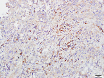 FCAR/CD89 Rabbit Polyclonal Antibody