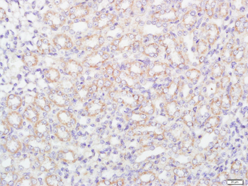 FCAR/CD89 Rabbit Polyclonal Antibody