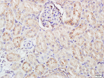 FCAR/CD89 Rabbit Polyclonal Antibody
