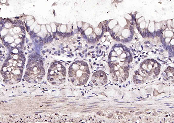 GATA2 Rabbit Polyclonal Antibody