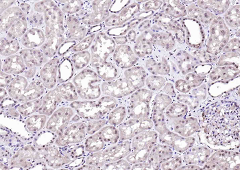 PP2A alpha + beta Rabbit Polyclonal Antibody
