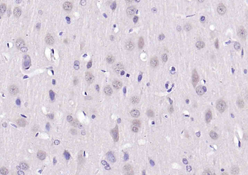 PP2A alpha + beta Rabbit Polyclonal Antibody