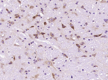 Uricase Rabbit Polyclonal Antibody