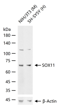 SOX11 Rabbit Polyclonal Antibody