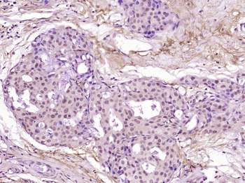 SOX11 Rabbit Polyclonal Antibody