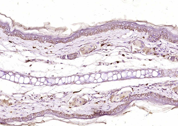 NR2C2 Rabbit Polyclonal Antibody