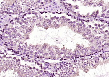 NR2C2 Rabbit Polyclonal Antibody