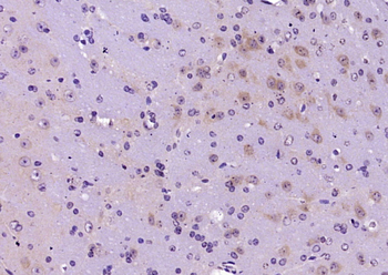 RBPJK Rabbit Polyclonal Antibody