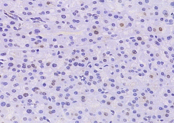 RBPJK Rabbit Polyclonal Antibody