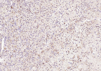 HRPT2 Rabbit Polyclonal Antibody