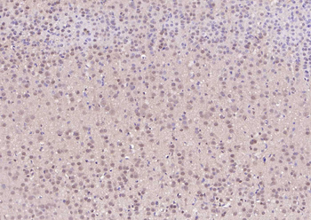 HRPT2 Rabbit Polyclonal Antibody