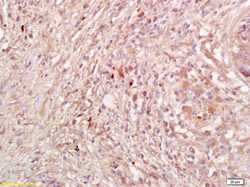 PDCD6IP Rabbit Polyclonal Antibody