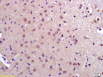 PDCD10 Rabbit Polyclonal Antibody