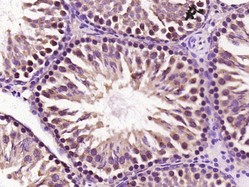 CYP1A1 Rabbit Polyclonal Antibody