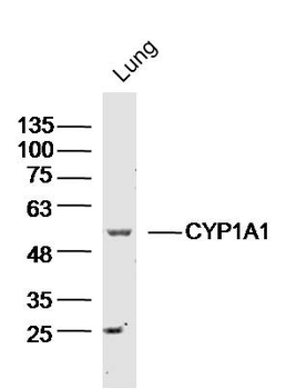CYP1A1 Rabbit Polyclonal Antibody