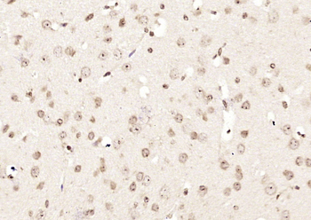 KIF4A Rabbit Polyclonal Antibody
