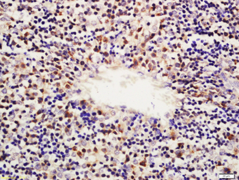 KIF4A Rabbit Polyclonal Antibody
