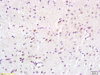 BS69 Rabbit Polyclonal Antibody