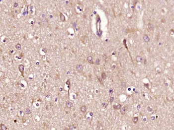 SCGB3A1 Rabbit Polyclonal Antibody