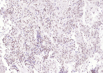 CDCA5 Rabbit Polyclonal Antibody