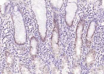 CDCA5 Rabbit Polyclonal Antibody