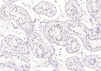 CDCA5 Rabbit Polyclonal Antibody